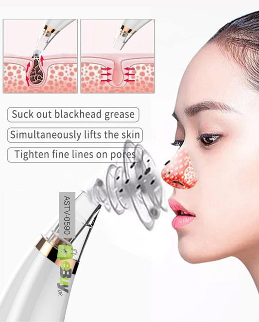 Aaron Mart Rechargable 6 section Blackhead Remover